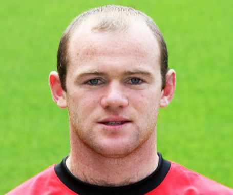 Wayne Rooney Gets Hair Transplant Number 2! - TRACE